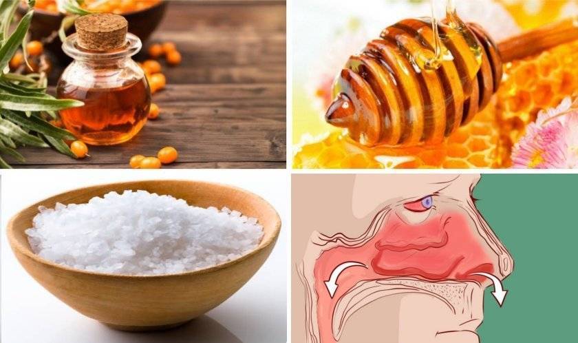 Лечение гайморита медом, содой и маслом: рецепты приготовления и правила приема