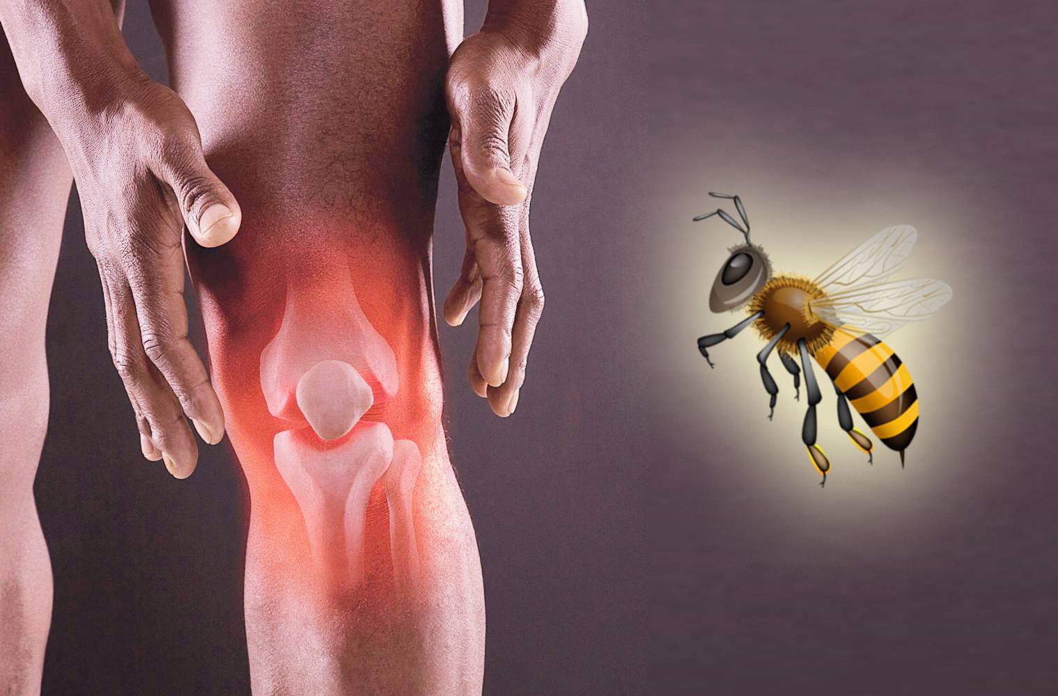 Лечение пчелиными укусами и пчелопродуктами — польза и вред пчелоужаливания для организма
