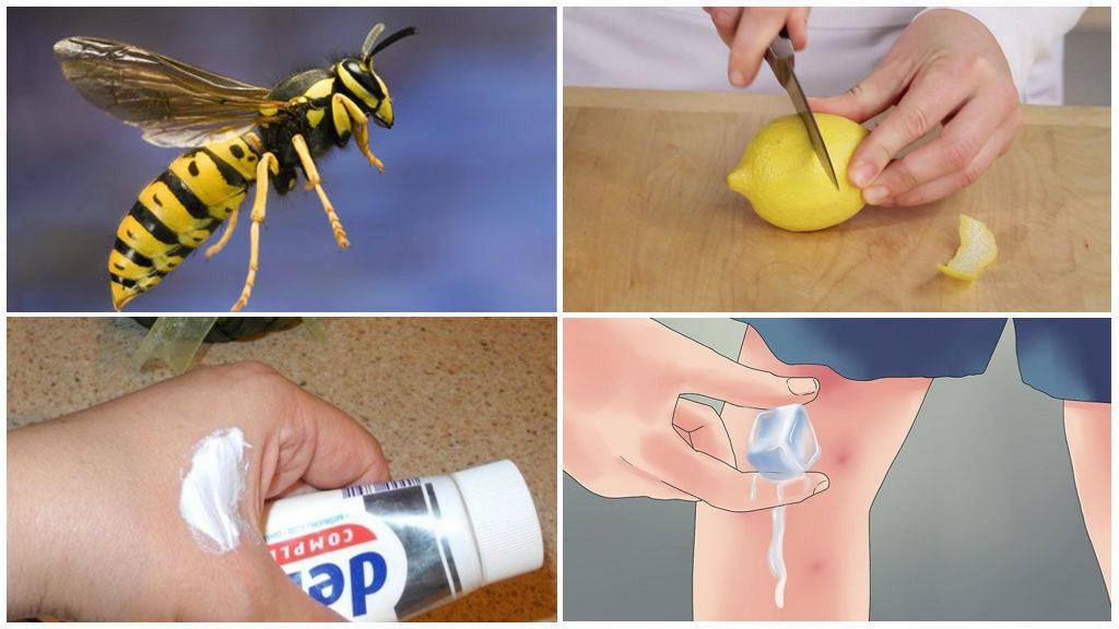 Пчела или оса укусиа в голову: что делать, первая помощь, лечение