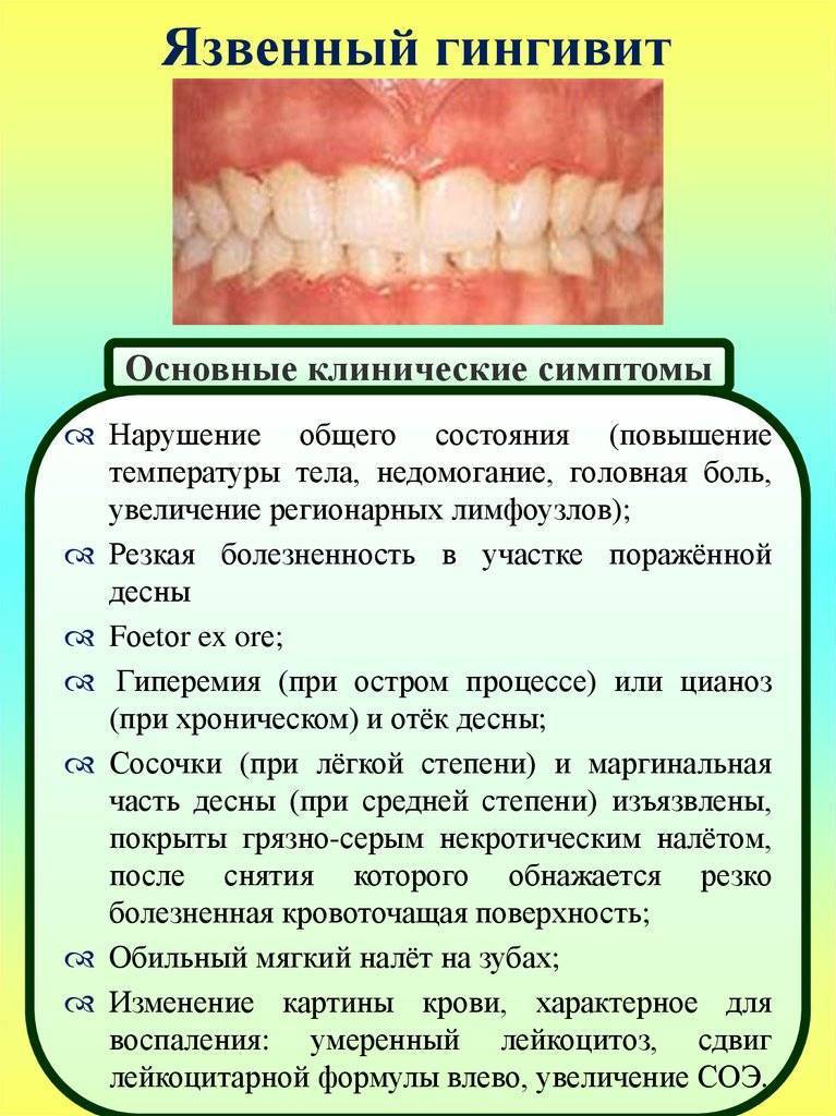 Кариес зубов — симптомы, виды, причины, профилактика | «см-стоматология»