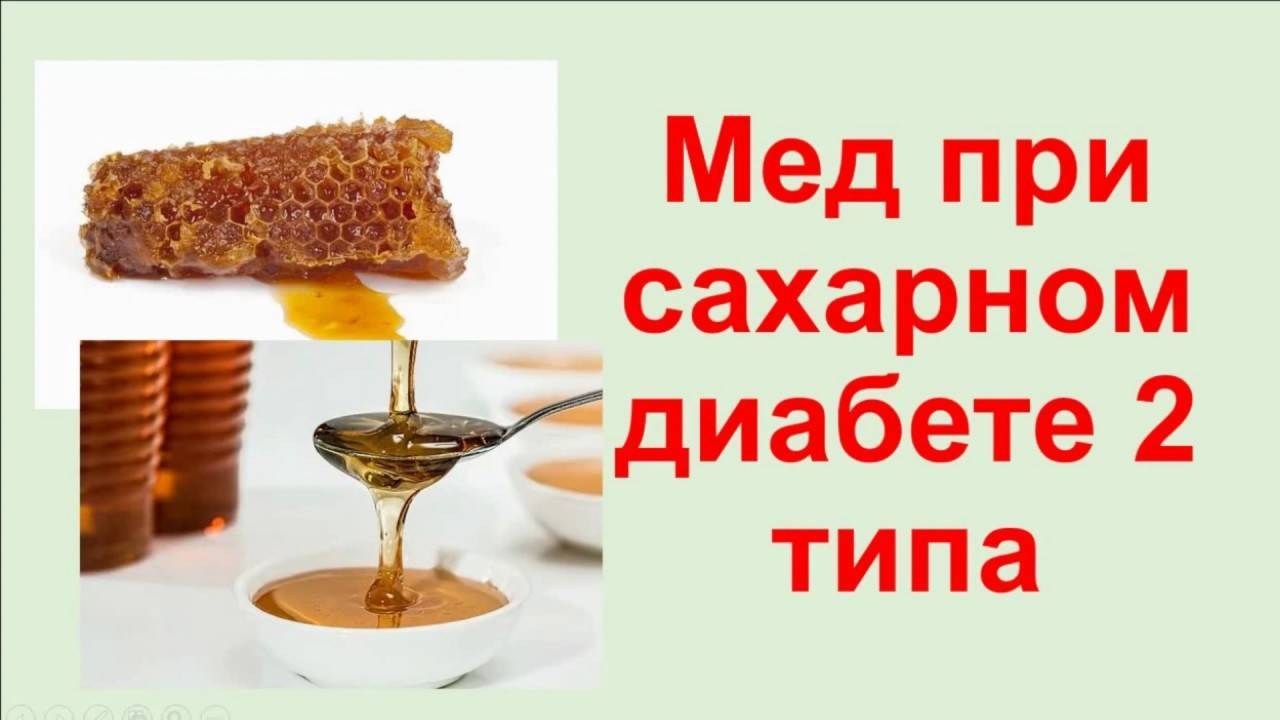 Можно ли есть мед при сахарном диабете 2 типа