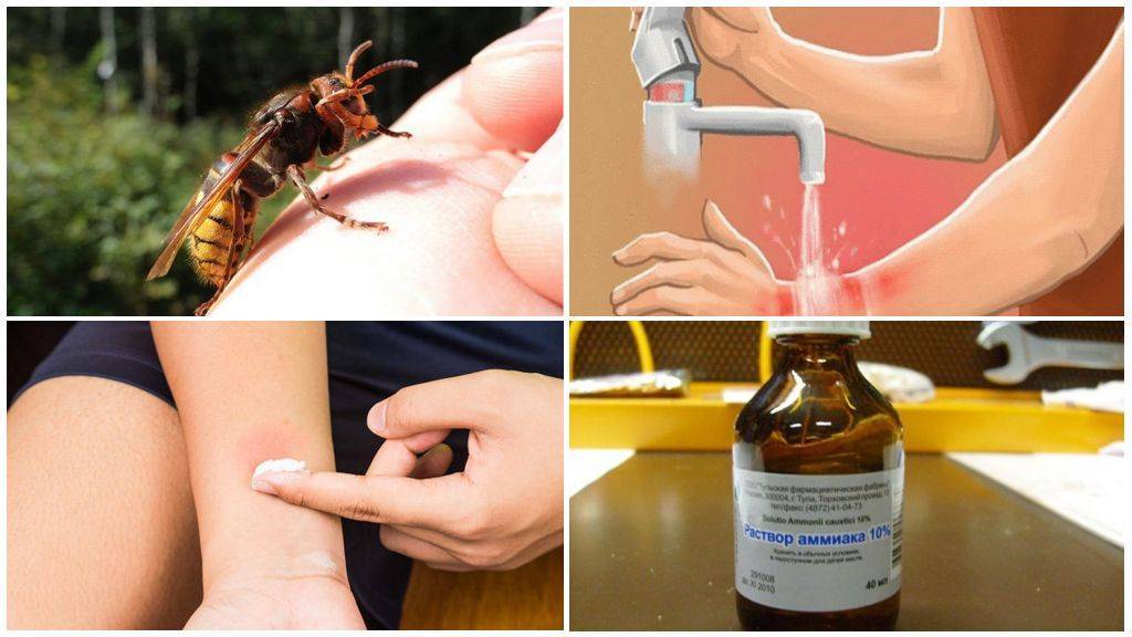 Оказание первой помощи при укусах насекомых: клещи, пчелы, осы, шершни