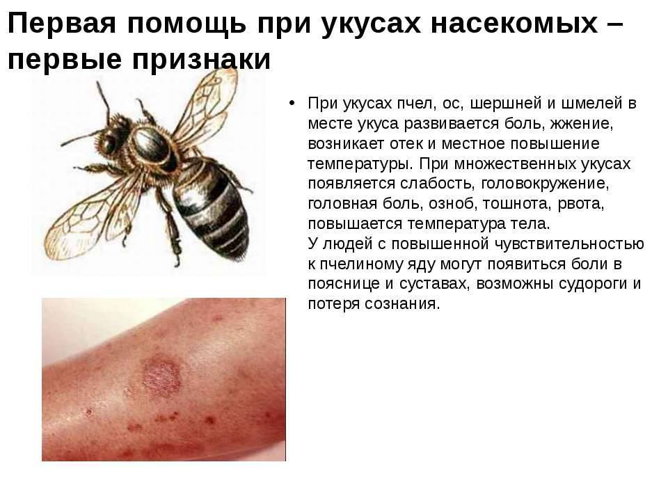 Укус пчелы в глаз - признаки, снятие отека, лечение и первая помощь