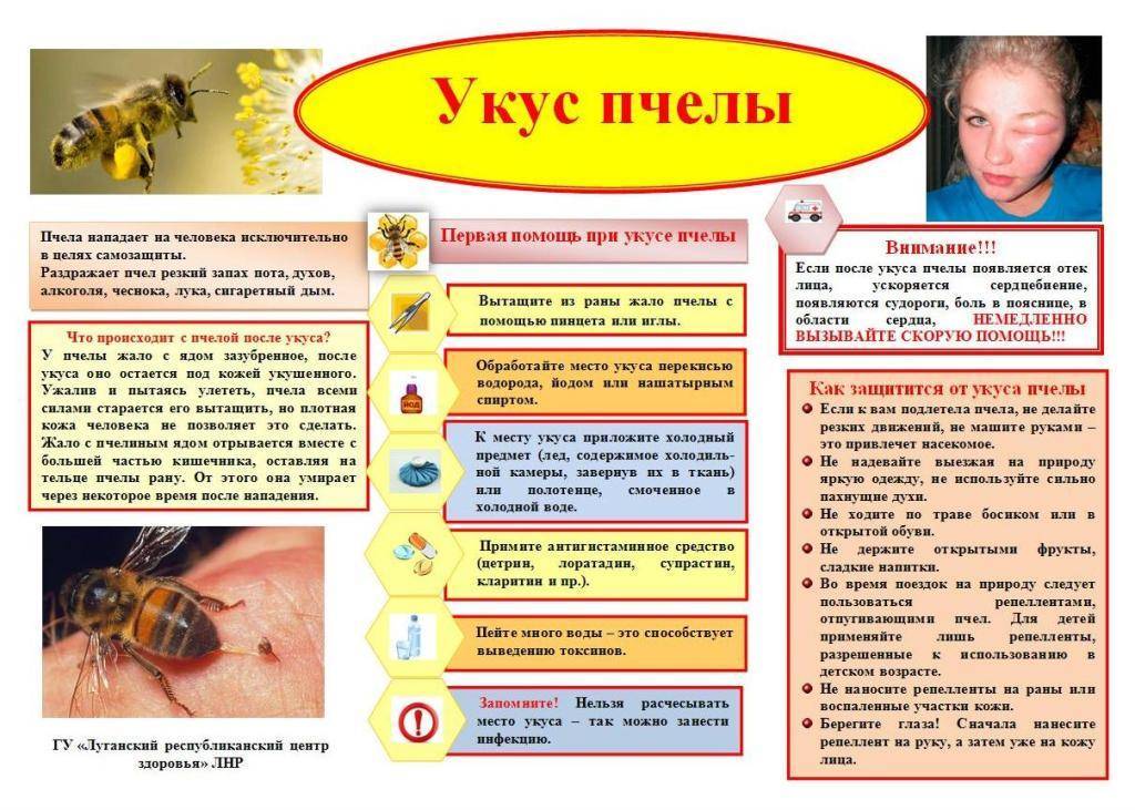 Укус пчелы: симптомы, первая помощь, лечение | мрикрнц.рф