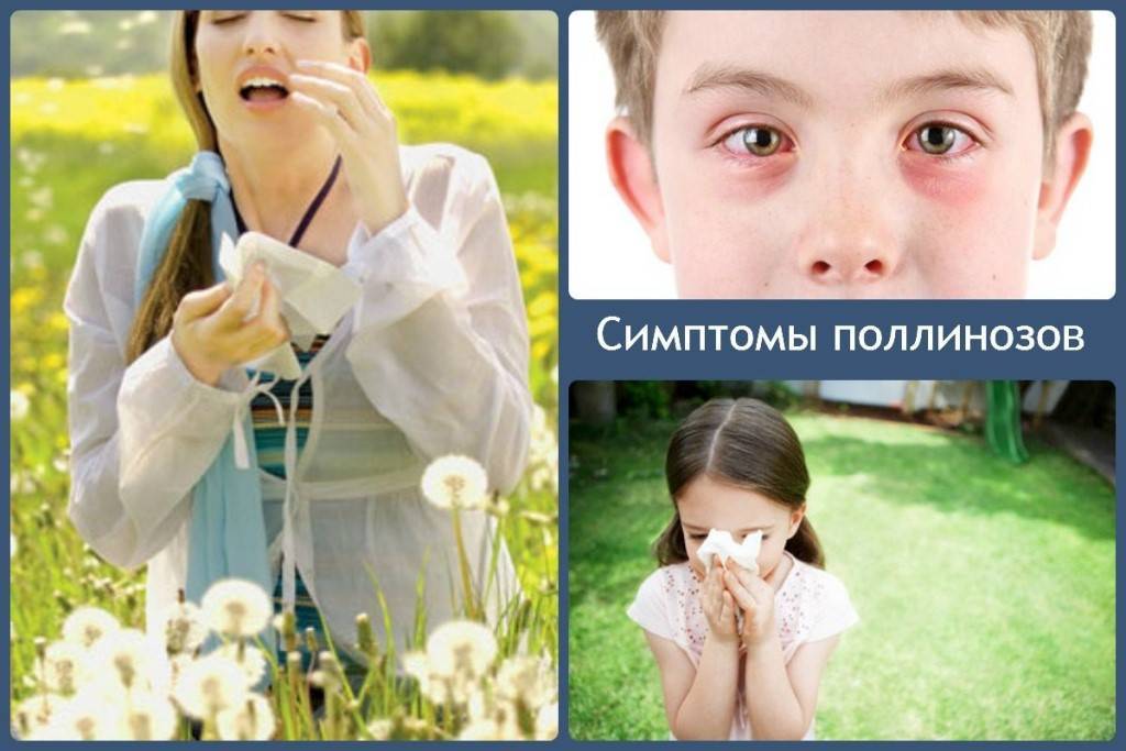 Аллергия на пыльцу травы является наиболее распространенной аллергией