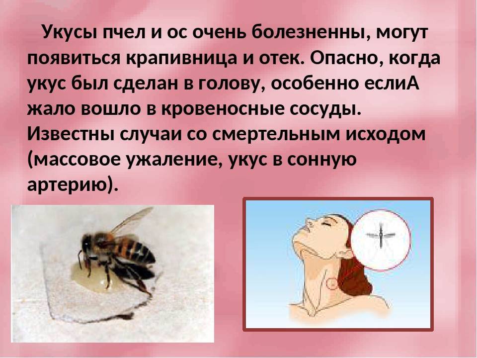 Укус осы: первая помощь, что делать в домашних условиях