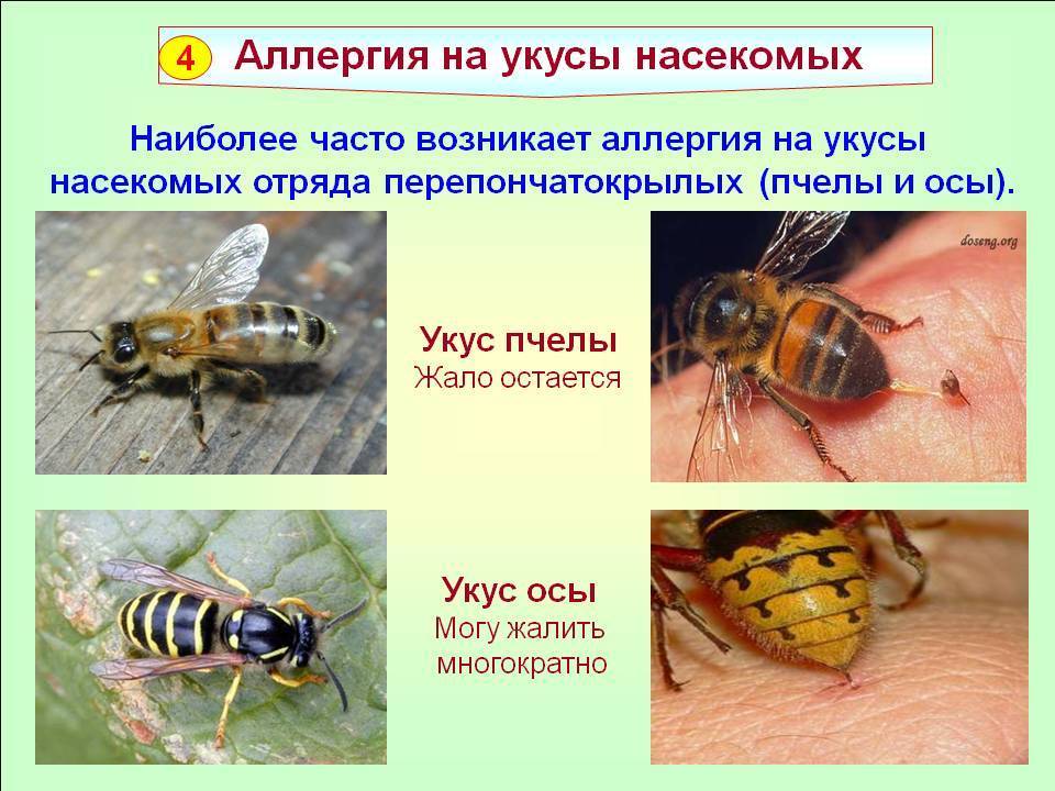 Укус пчелы: как снять отек, что делать после укуса пчелы в домашних условиях  - medside.ru