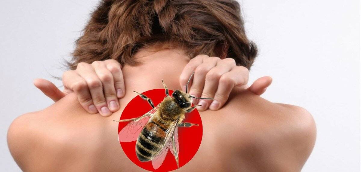Лечение пчелами: вред и польза. мнение коллеги.