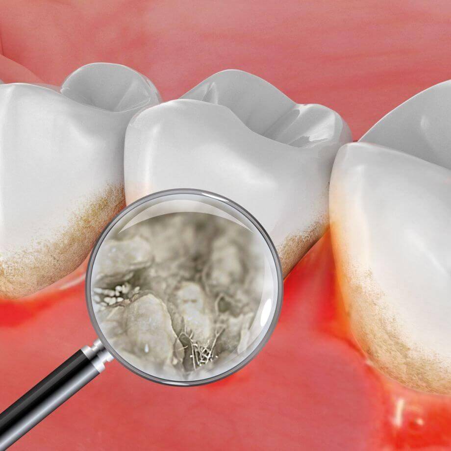 Стоматологическое лечение зубов |
