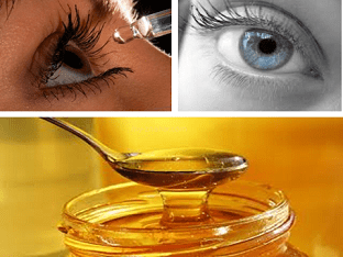 Лечение глаз медом в домашних условиях: лучшие рецепты приготовления, полезные свойства и правила приема